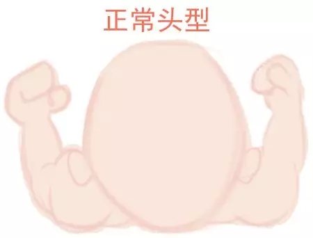 ԲͷվɱͷЩ趼֪1.webp.jpg