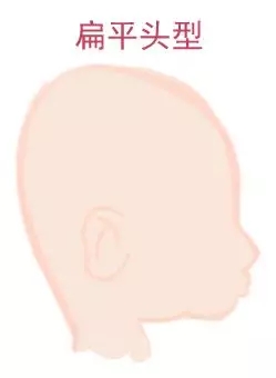ԲͷվɱͷЩ趼֪4.webp.jpg