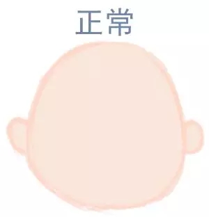 ԲͷվɱͷЩ趼֪5.webp.jpg